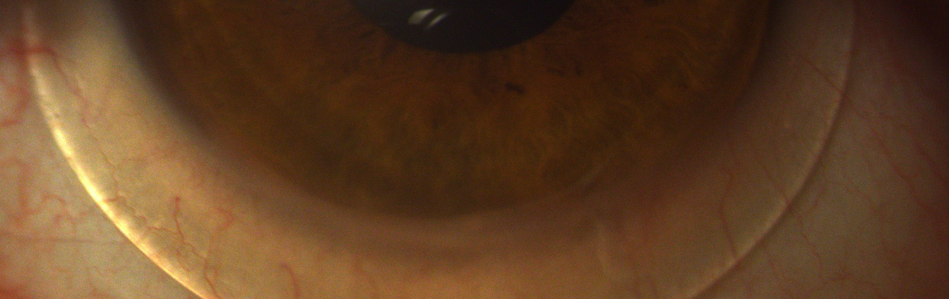 standard prescription contact lenses Parley Optometrists