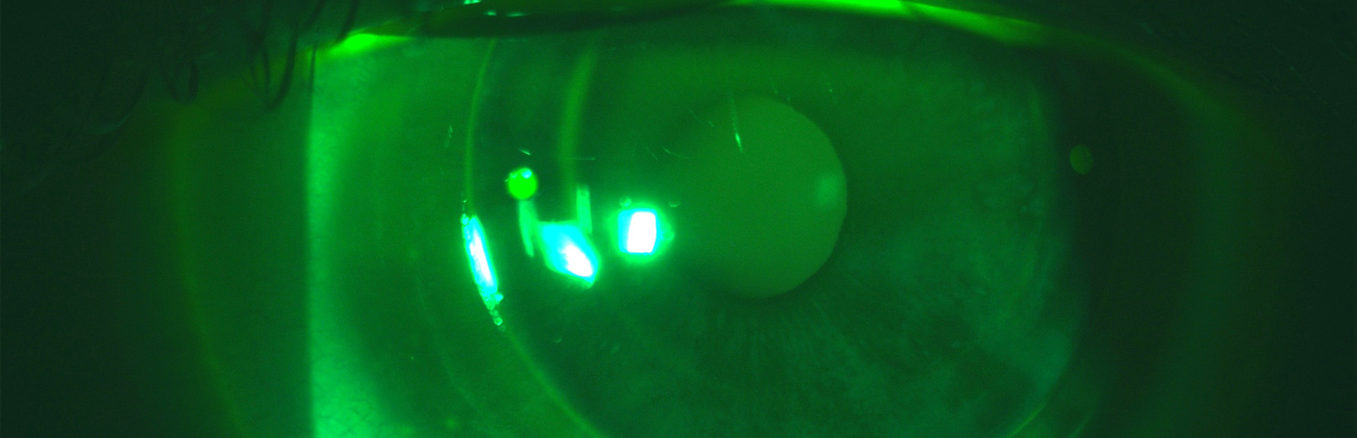 specialist contact lenses Parley Optometrists